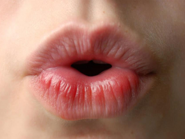 Redução de lábios, Bardotização e histeria estética nas Redes Sociais