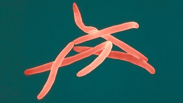 fusobacteria nucleatum