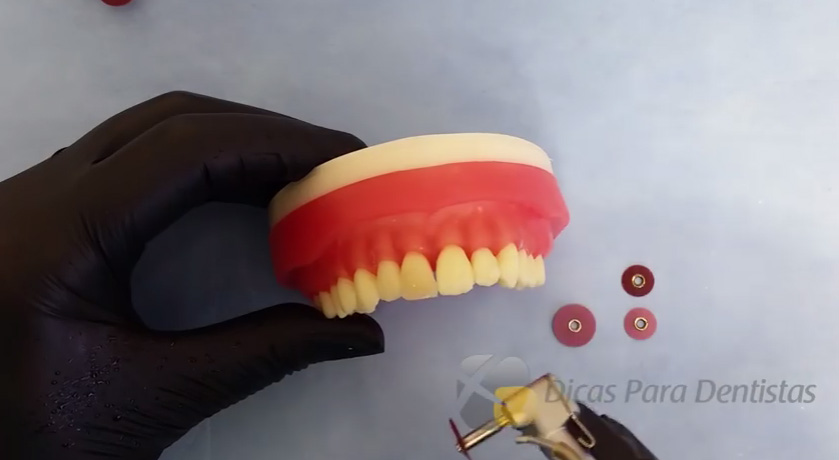 acabamento-e-polimento-resinas-dicas-da-dentista