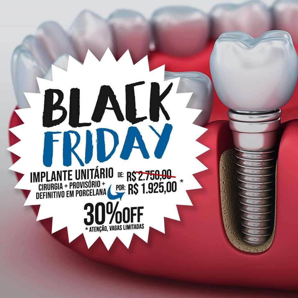 Black Friday na Odontologia - Pode ou não pode? - Dicas Odonto